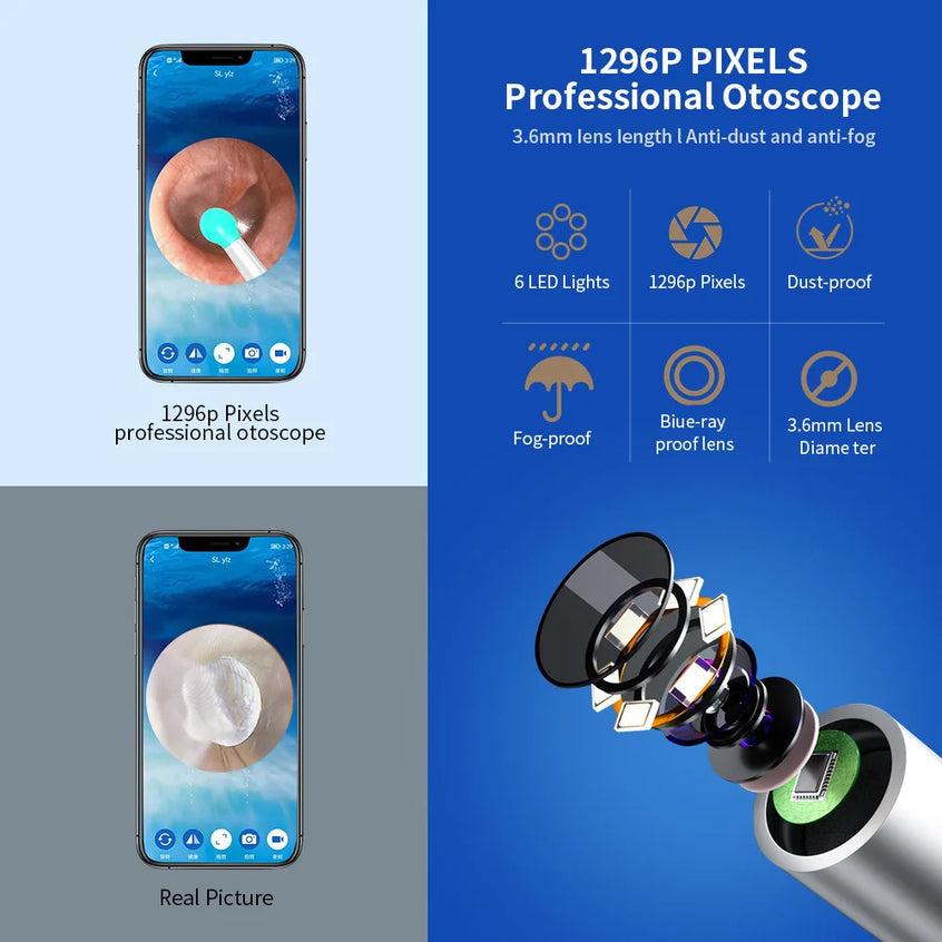 Smart Visual Ear Wax Cleaner